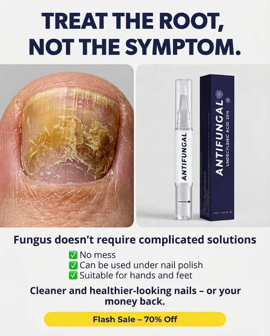 Antifungal Pen - 25% Undecylenic Acid